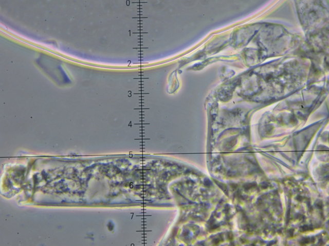 Botryobasidium con spore finemente verrucose